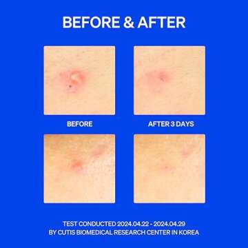 KNEMO Right Away Thincognito Invisible Spot Patch for Instant Relief