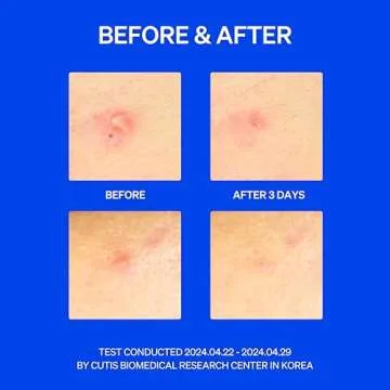 KNEMO Right Away Thincognito Invisible Spot Patch for Instant Relief