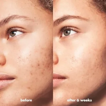 e.l.f. Blemish Breakthrough Calming Water Cream