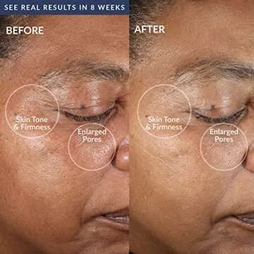 PMD Clean Pro Facial Cleansing Device with Massage