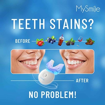 MySmile Teeth Whitening Kit with LED Light for a Bright Smile