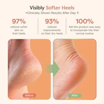ZenToes Moisturizing Sleep Socks with Vitamin E, Olive Oil and Jojoba Seed Oil to Soften and Hydrate Dry Cracked Heels (Fuzzy Pink, Regular)
