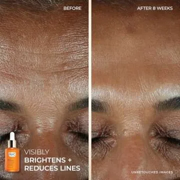 RoC Vitamin C Serum & Cream Bundle for Brighter Skin