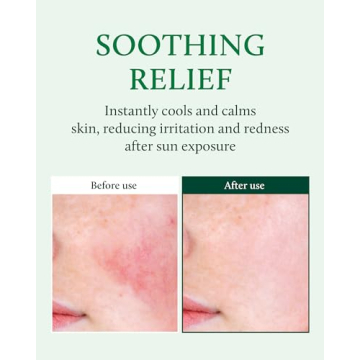 YADAH Cactus Soothing Gel for Skin Relief and Hydration