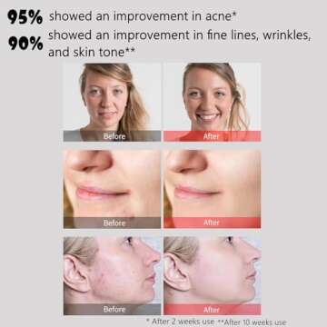 Aphrona Led Face Mask Light Therapy, Halo Led Light Therapy Facial and Neck Skin Care Mask, Blue Light Red Light for Acne Wrinkle Reduce, New Generation Face and Neck Photon Mask