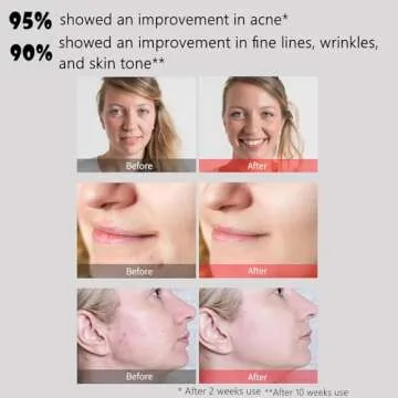 Aphrona Led Face Mask Light Therapy, Halo Led Light Therapy Facial and Neck Skin Care Mask, Blue Light Red Light for Acne Wrinkle Reduce, New Generation Face and Neck Photon Mask