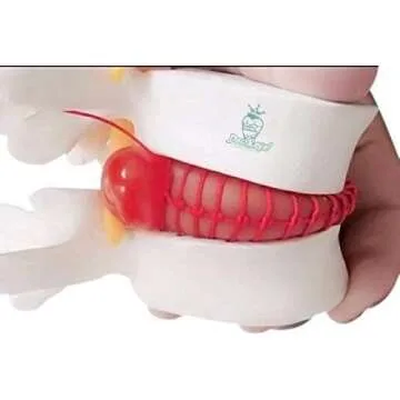 Lumbar Spine Model for Patient Education and Training