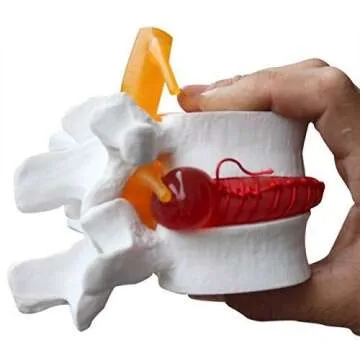 Lumbar Spine Model for Patient Education and Training