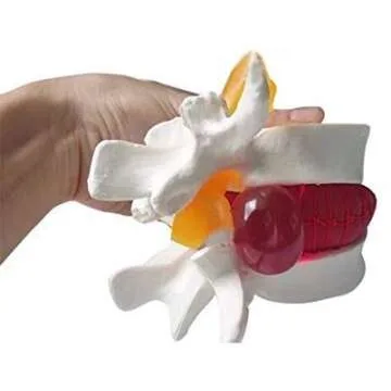 Lumbar Spine Model for Patient Education and Training