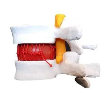 Lumbar Spine Model for Patient Education and Training