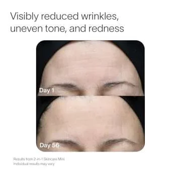 Solawave 2 in 1 Anti-Aging Face & Body Skincare Mini with Red and Infrared Light + Therapeutic Warmth for Skin Rejuvenation, Wrinkles, Fine Lines, Blemishes, and Dark Spots