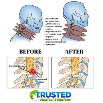 Trusted Cervical Neck Traction Device - One Size Fits All Necks - US Owned Registered - Relief for Chronic Neck & Shoulder Alignment Pain - Inflatable Neck Stretcher Collar for Home Relief