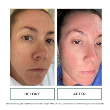 Replenix Glycolic Acid 10% Skin Peel Pads for Radiant Skin