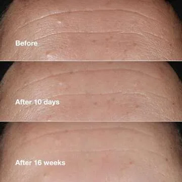 Clinique Smart Repair Serum with Hyaluronic Acid & Peptides