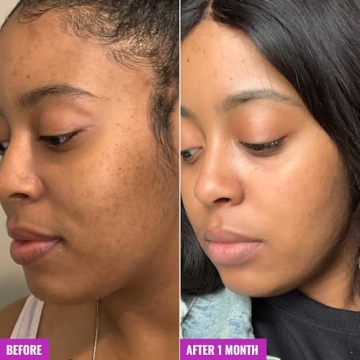 Good Molecules Glycolic Exfoliating Toner for Radiant Skin