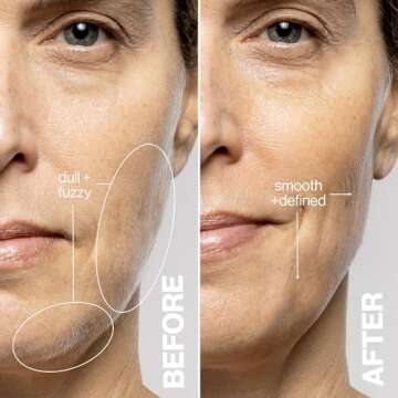 DERMAFLASH LUXE+ Sonic Tool for Peach Fuzz Removal and Exfoliation