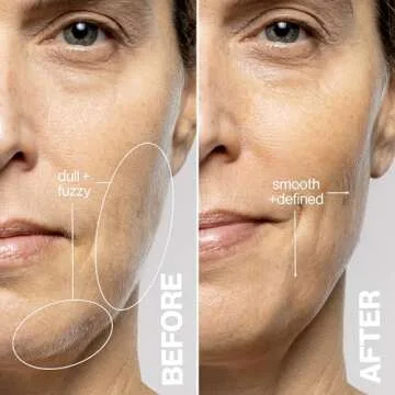 DERMAFLASH LUXE+ Sonic Tool for Peach Fuzz Removal and Exfoliation