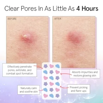 grace & stella Award Winning Pimple Patches For Face (Multishape, 36 Count) - Hydrocolloid Acne Patches for Face - Dermatologist Tested, Vegan, Cruelty-Free Zit Patches for Face, Blemish Patches