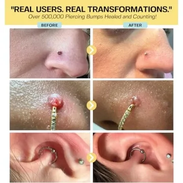 Natural Piercing Bump Solution for Smooth, Clear Skin | 0.5 oz