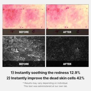 Medicube Super Cica Facial Toner Pads for Sensitive Skin