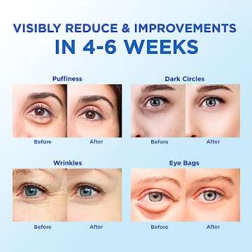 Eye Patches for Puffy Eyes 60 Pcs, 24k Gold Under Eye Patches for Dark Circles and Puffiness, Under Eye Mask Patches for Wrinkles, Dark Circles Under Eye Bags Treatment For Women And Men