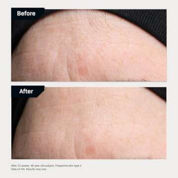 Fine Lines & Wrinkles Targeted Serum with Hyaluronic Acid