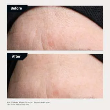 Fine Lines & Wrinkles Targeted Serum with Hyaluronic Acid