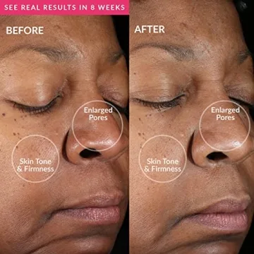 PMD Clean Mini Facial Cleansing Device with Sonic Technology