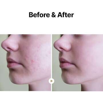 MAY COOP Raw Moisturizer Face Cream With Maple Tree Water-daily Hydrating Facial Moisturizer Cream- Anti Aging- For All Skin Types- Helps Prevent Wrinkles- Vegan And Alcohol-Free -80ml