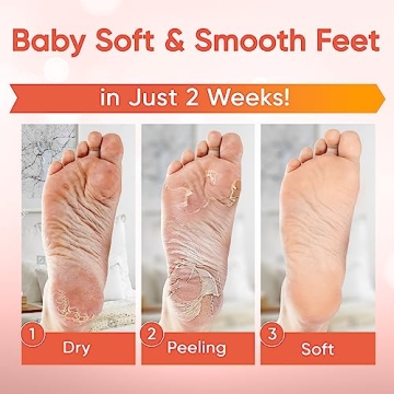 Foot Peel Mask - Baby Soft Skin with Aloe Vera