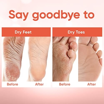 Foot Peel Mask - Baby Soft Skin with Aloe Vera