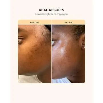 Buttah Skin Supreme Kit for Melanin Rich Skin | CocoShea Revitalizing Cream 2 oz | Vitamin C Serum 1 oz | Cleanser 3.4 oz | Rosewater Toner 3.4 oz | Black Owned Skincare