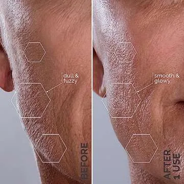 Michael Todd Beauty - Sonicsmooth - Dermaplane Razor for Women Face - SONIC Technology Dermaplaning Tool - 2 in 1 Women’s Facial Exfoliation & Peach Fuzz Hair Removal System- 8 Weeks of Safety Edges