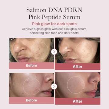 medicube Salmon DNA PDRN Pink Peptide Serum, Pink glow serum, Peptide, Niacinamide, Hydrating & Mois...