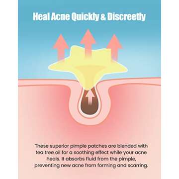 Jefusst Star Acne Pimple Patch 140 Counts - Fashionable Care