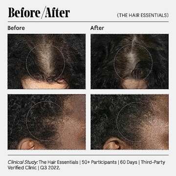 Nécessaire The Scalp Serum. 5% Capixyl™ + 1% Hyaluronic Acid For Fuller, Thicker, Healthier Hair. Fragrance-Free. Approved by the National Eczema Association. 2 fl oz