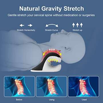 Liipoo Heated Neck Stretcher with Magnetic Therapy Pillowcase, Neck and Shoulder Relaxer Pillows, Cervical Traction Device for Relieve TMJ Headache Muscle Tension Spine Alignment…