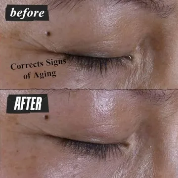 Kiehl's Multi-Corrective Eye Cream Anti-Aging Formula