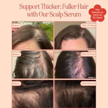 INH Hair Serum | G2G Biotin & Caffeine Scalp Treatment That Supports Natural Hair Growth | Non Comed...