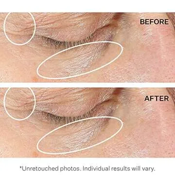 Strivectin Anti-Wrinkle Eye Cream for Youthful Eyes