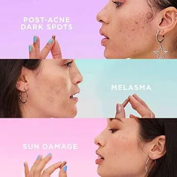 ZitSticka Vitamin Acne Supplement for Cystic Acne w/ 30 Natural Caps for Women and Men, Supplements for Hormonal Support, Skin Clarity, Dark Spots - Dermatologist Tested (Blur Potion™)