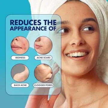 Dermisa Sulfur Bar with Aloe Vera for Oily Skin