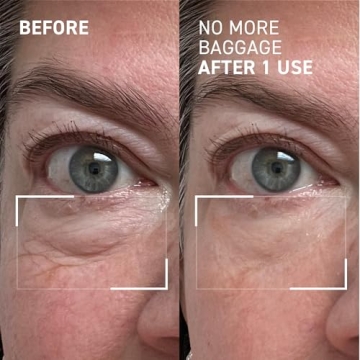 Dr. Brandt Eye De-Puffing Gel for Radiant Skin