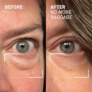 Dr. Brandt Eye De-Puffing Gel for Radiant Skin