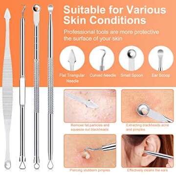 Pimple Popper Tool Kit, IUMAKEVP 15 PCS Professional Stainless Steel Blackhead Remover Comedone Extractor Tools for Removing Zit on Face - Acne Removal Kit with Metal Case (Silver)
