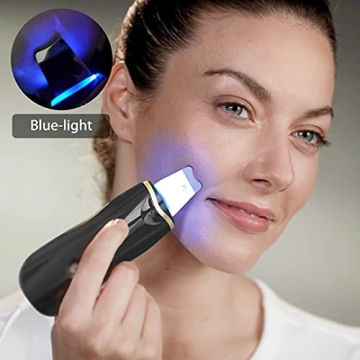 Qukot Ultrasonic Skin Scrubber & Blue-Light Blackhead Remover