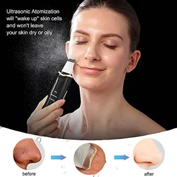 Qukot Ultrasonic Skin Scrubber & Blue-Light Blackhead Remover