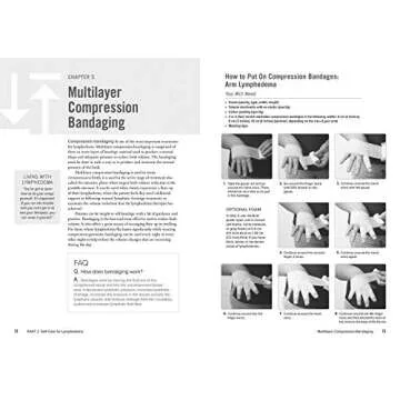 The Complete Lymphedema Management and Nutrition Guide: Empowering Strategies, Supporting Recipes and Therapeutic Exercises