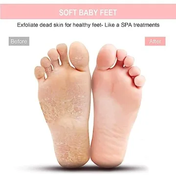 BESKAR XL Foot Scrubber Mat for Calluses & Achy Feet Relief