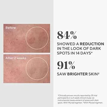 Murad Rapid Dark Spot Correcting Serum - Skin Brightening Face Serum for Hyperpigmentation - Glycolic Acid Treatment Backed by Science, Travel Size 0.33Fl Oz